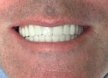 dental-image2